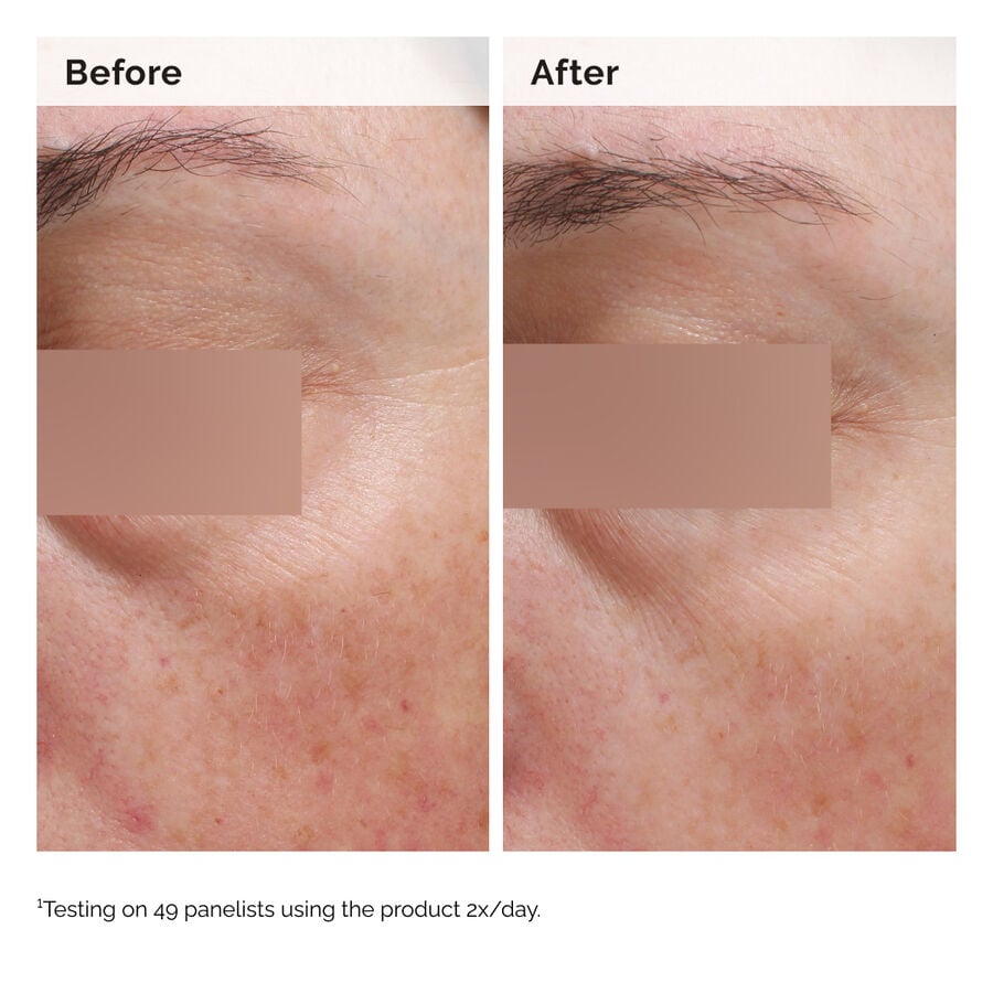 niacinamide-5-face-and-body-emulsion-u1 2024-08-23-ORD-Nia-5pct-Face-Body-B-A-Elasticity-Global-02-1x1.jpg