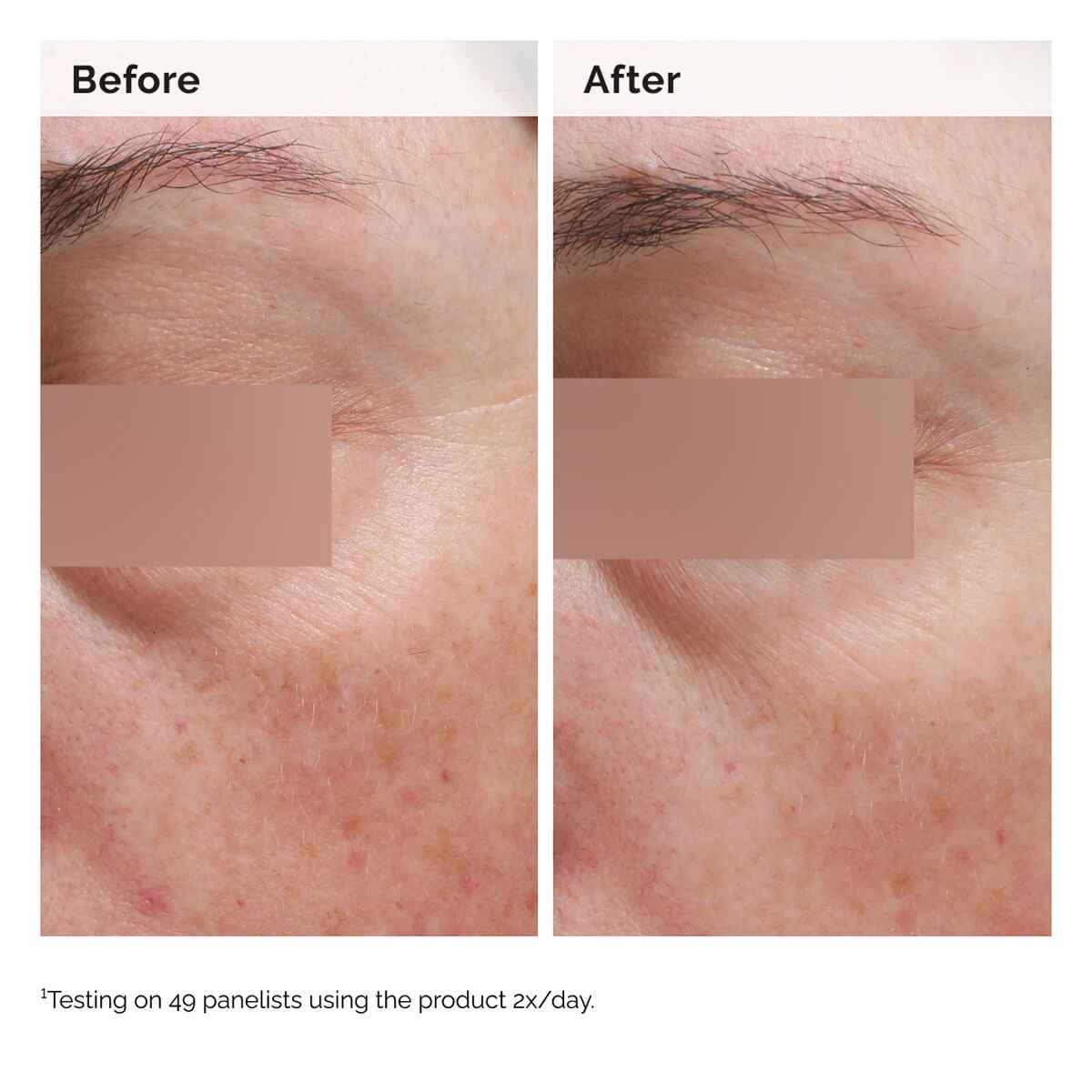 niacinamide-5-face-and-body-emulsion-i2 2024-08-23-ORD-Nia-5pct-Face-Body-B-A-Elasticity-Global-02-1x1.jpg