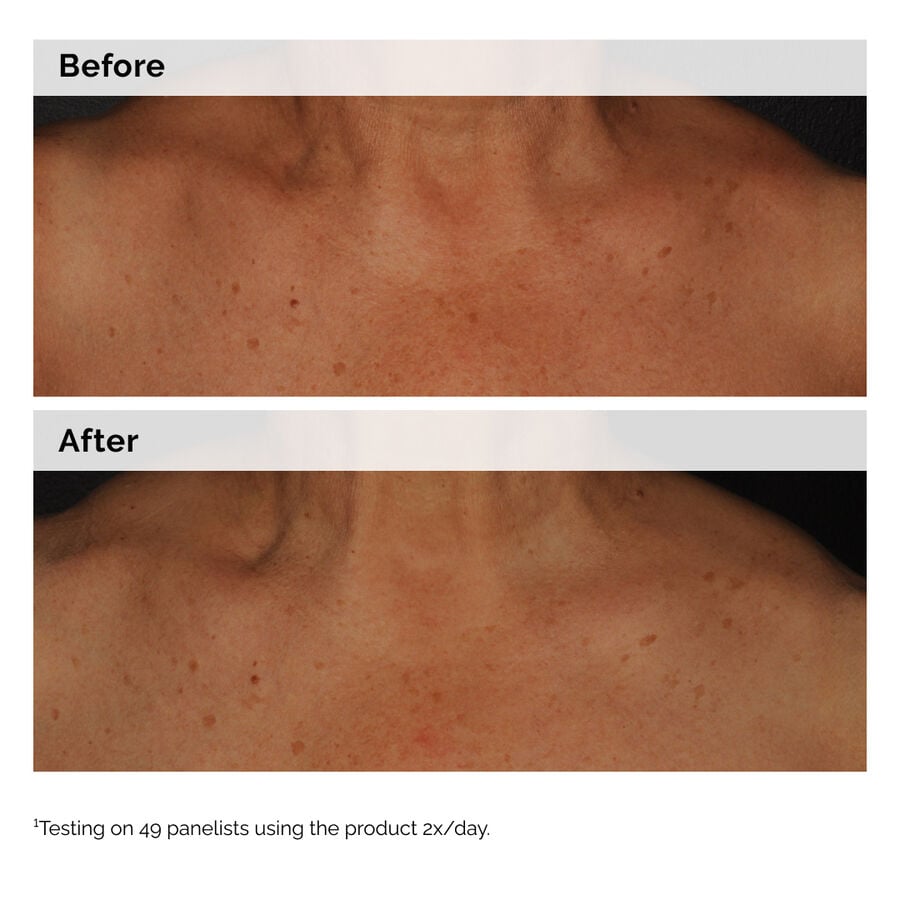 niacinamide-5-face-and-body-emulsion-i2 2024-08-23-ORD-Nia-5pct-Face-Body-B-A-Global-02-1x1.jpg