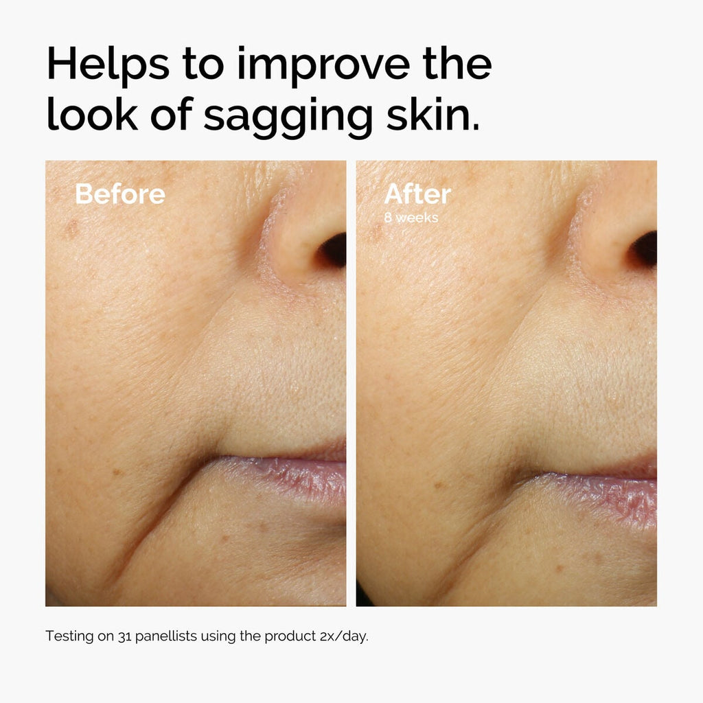 caffeine-3-escin-1-face-serum-x9 ord-caffeine-3pct-escin-1pct-face-serum-before-after-sagging.jpg