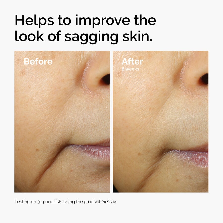caffeine-3-escin-1-face-serum-x9 ord-caffeine-3pct-escin-1pct-face-serum-before-after-sagging.jpg