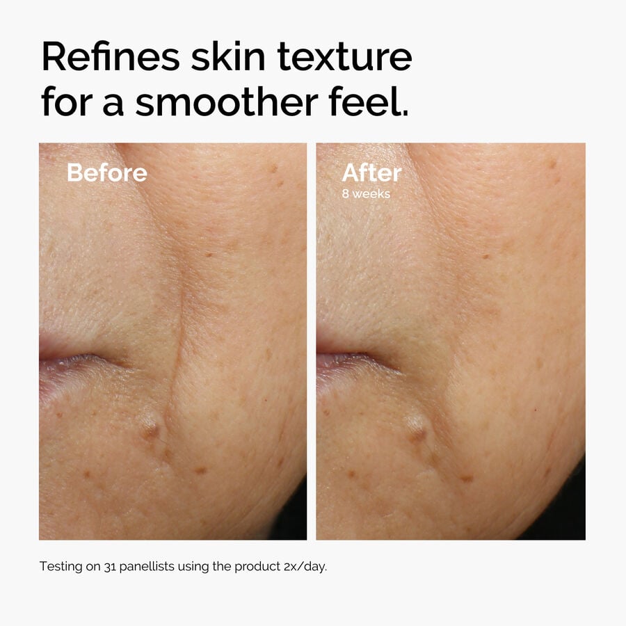 caffeine-3-escin-1-face-serum-x9 ord-caffeine-3pct-escin-1pct-face-serum-before-after-texture.jpg