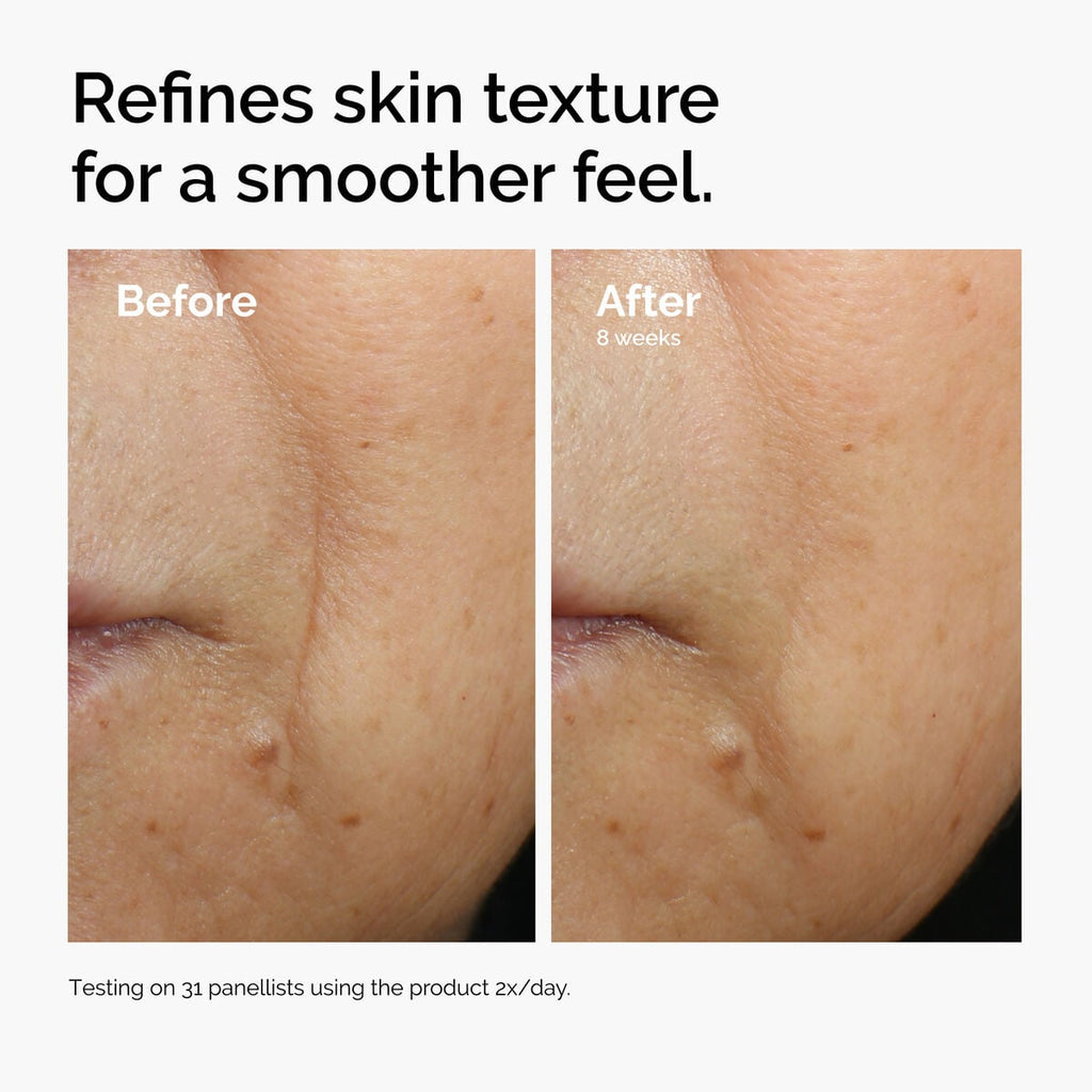 caffeine-3-escin-1-face-serum-x9 ord-caffeine-3pct-escin-1pct-face-serum-before-after-texture.jpg