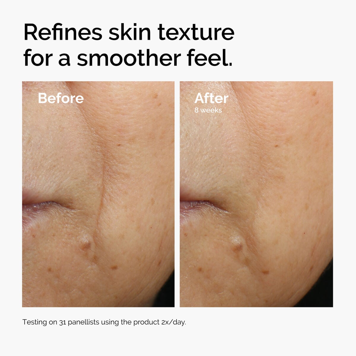 caffeine-3-escin-1-face-serum-x9 ord-caffeine-3pct-escin-1pct-face-serum-before-after-texture.jpg