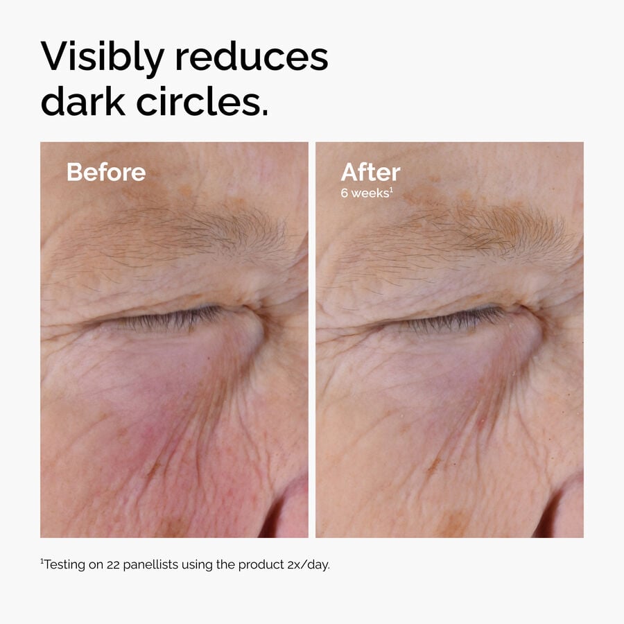 caffeine-solution-5-egcg-eye-serum-f5 ord-caffeine-solution-egcg-dark-circles-before-after.jpg