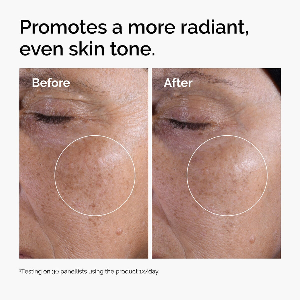 glycolic-acid-7-exfoliating-toner-a5 ord-glycolic-before-after-radiance.jpg