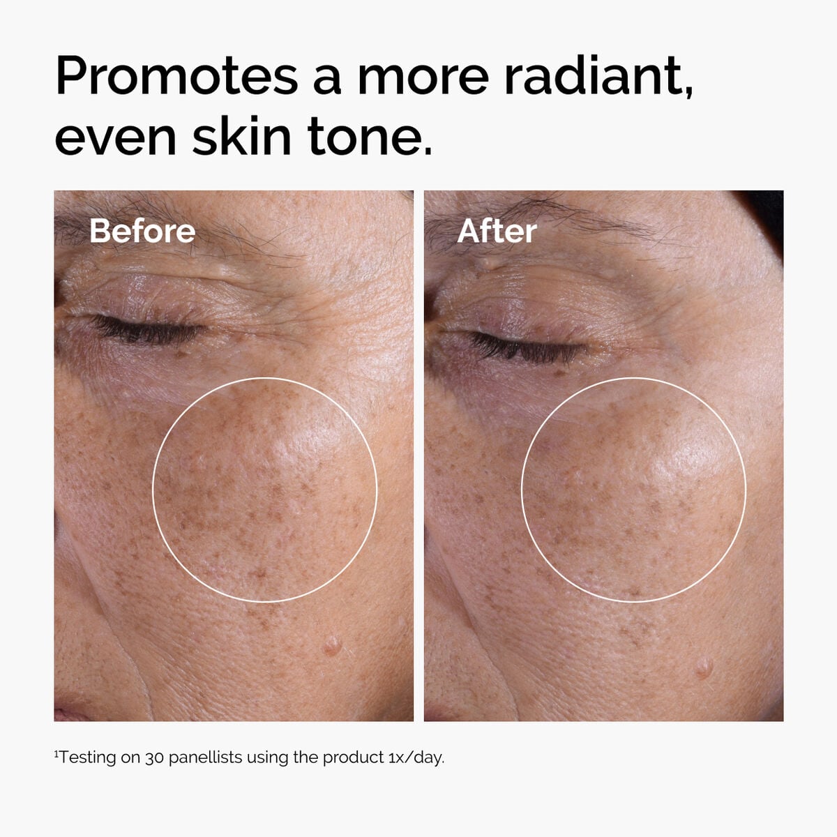 glycolic-acid-7-exfoliating-toner-a5 ord-glycolic-before-after-radiance.jpg