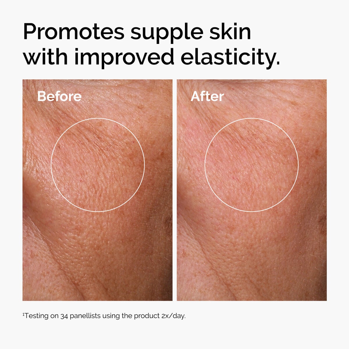 hyaluronic-acid-2-b5-with-ceramides-c3 ord-hyaluronic-acid-2pct-b5-hydrating-serum-before-after-elasticity.jpg