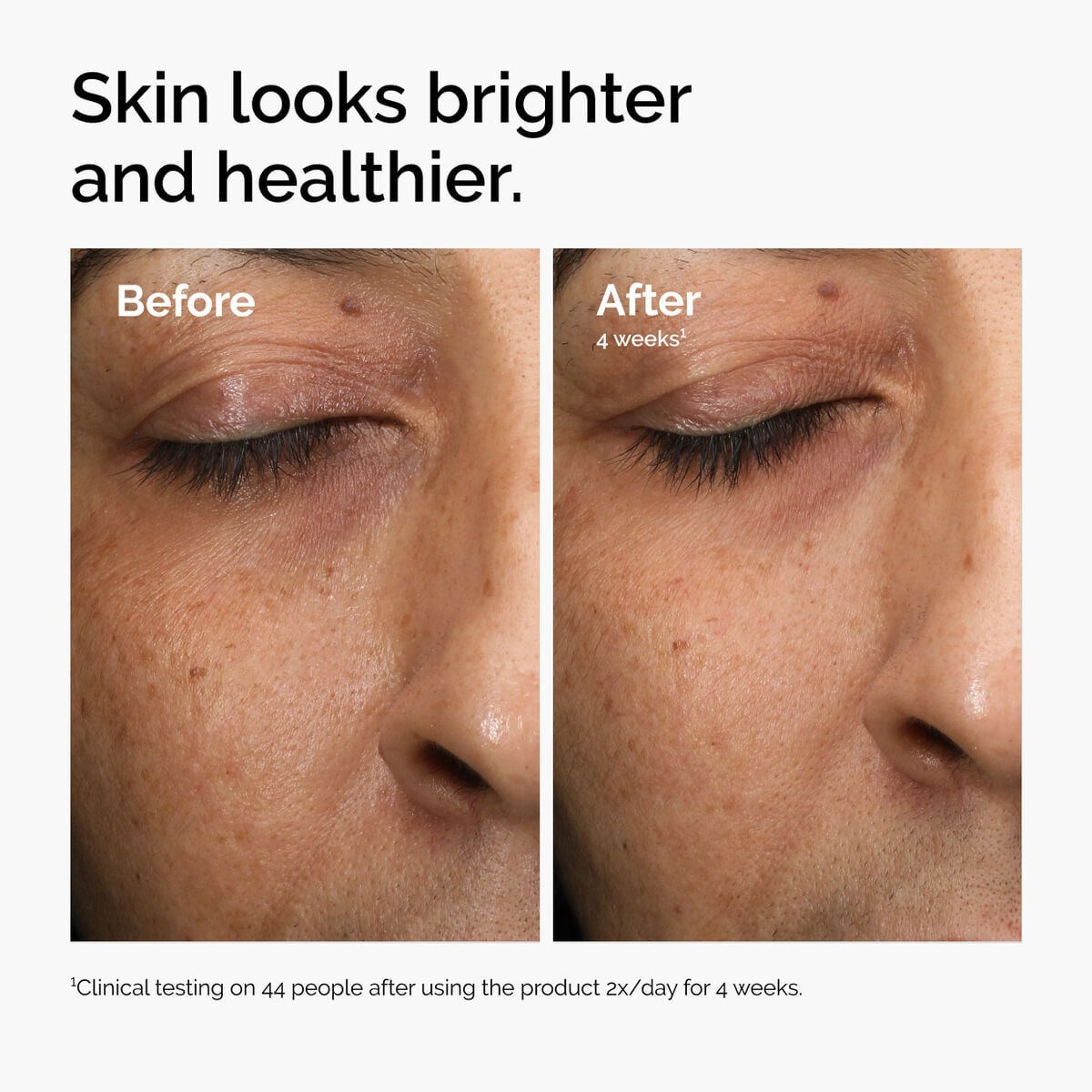 multi-antioxidant-radiance-serum-x9 ord-mars-before-after-healthy.jpg