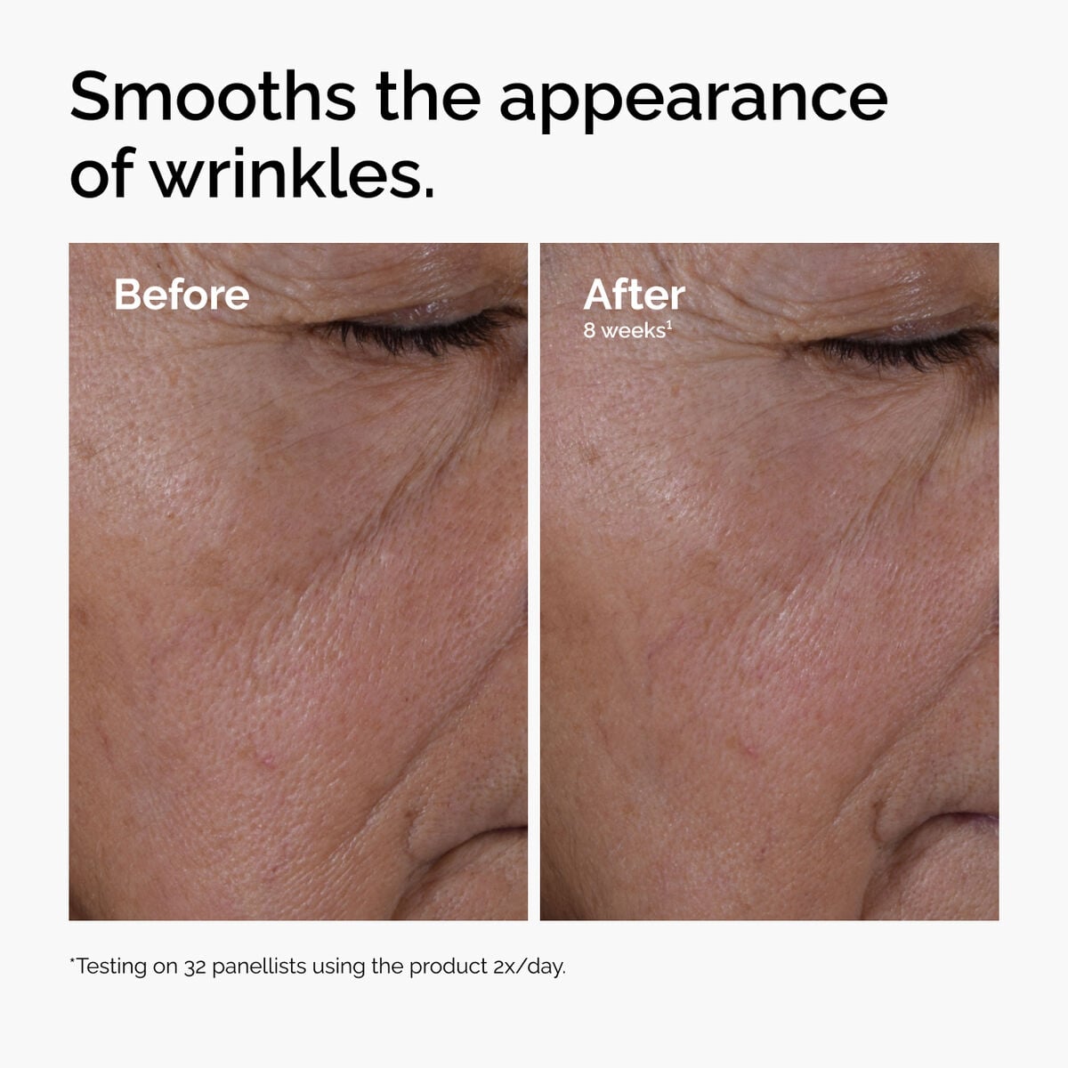 multi-peptide-ha-serum-m2 ord-multi-peptide-ha-serum-wrinkles-before-after.jpg