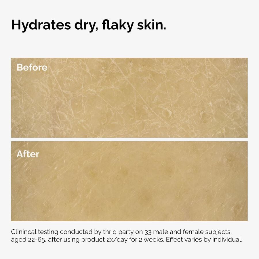 the-body-care-collection-g8 ord-natural-moisturizing-factors-inulin-body-before-after-graphic-02.jpg
