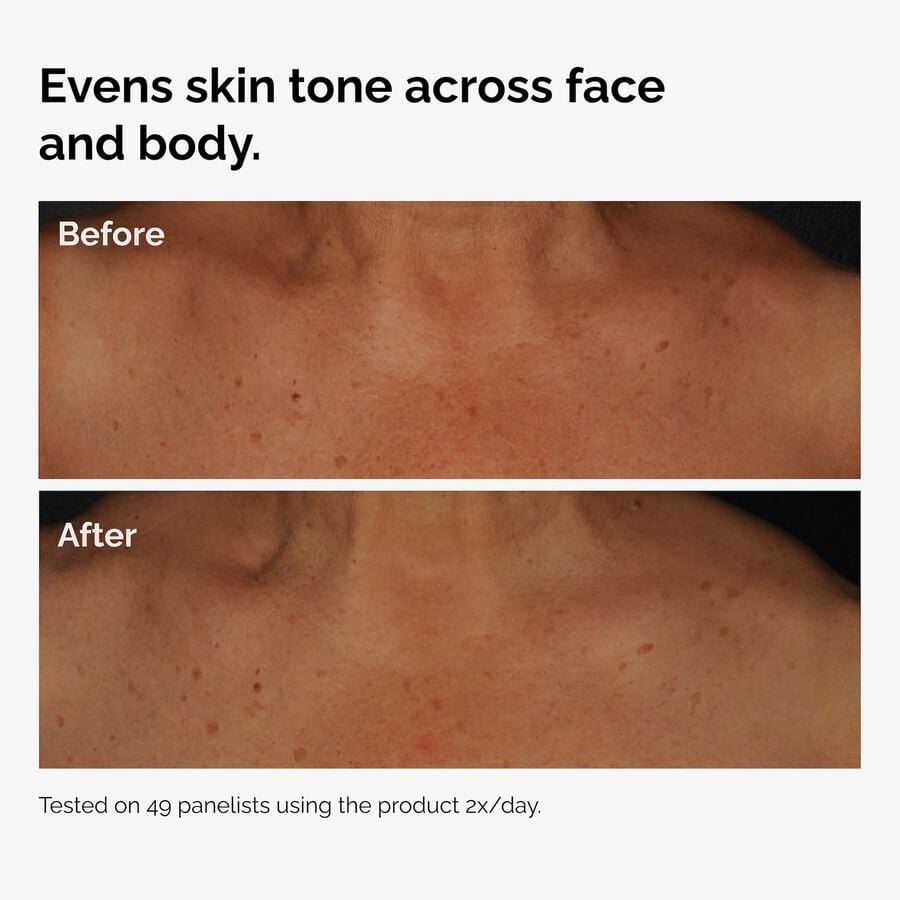 the-body-care-collection-g8 ord-niacinamide-face-body-serum-before-after-even-tone-graphic.jpg