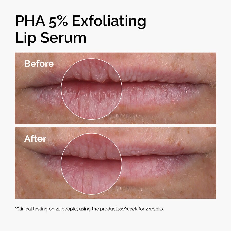 pha-5-exfoliating-lip-serum-z4 ord-pha-5pct-lip-exfoliating-serum-before-after.jpg