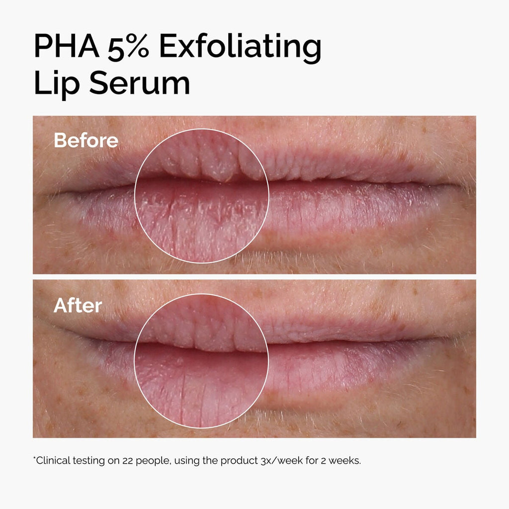 pha-5-exfoliating-lip-serum-z4 ord-pha-5pct-lip-exfoliating-serum-before-after.jpg