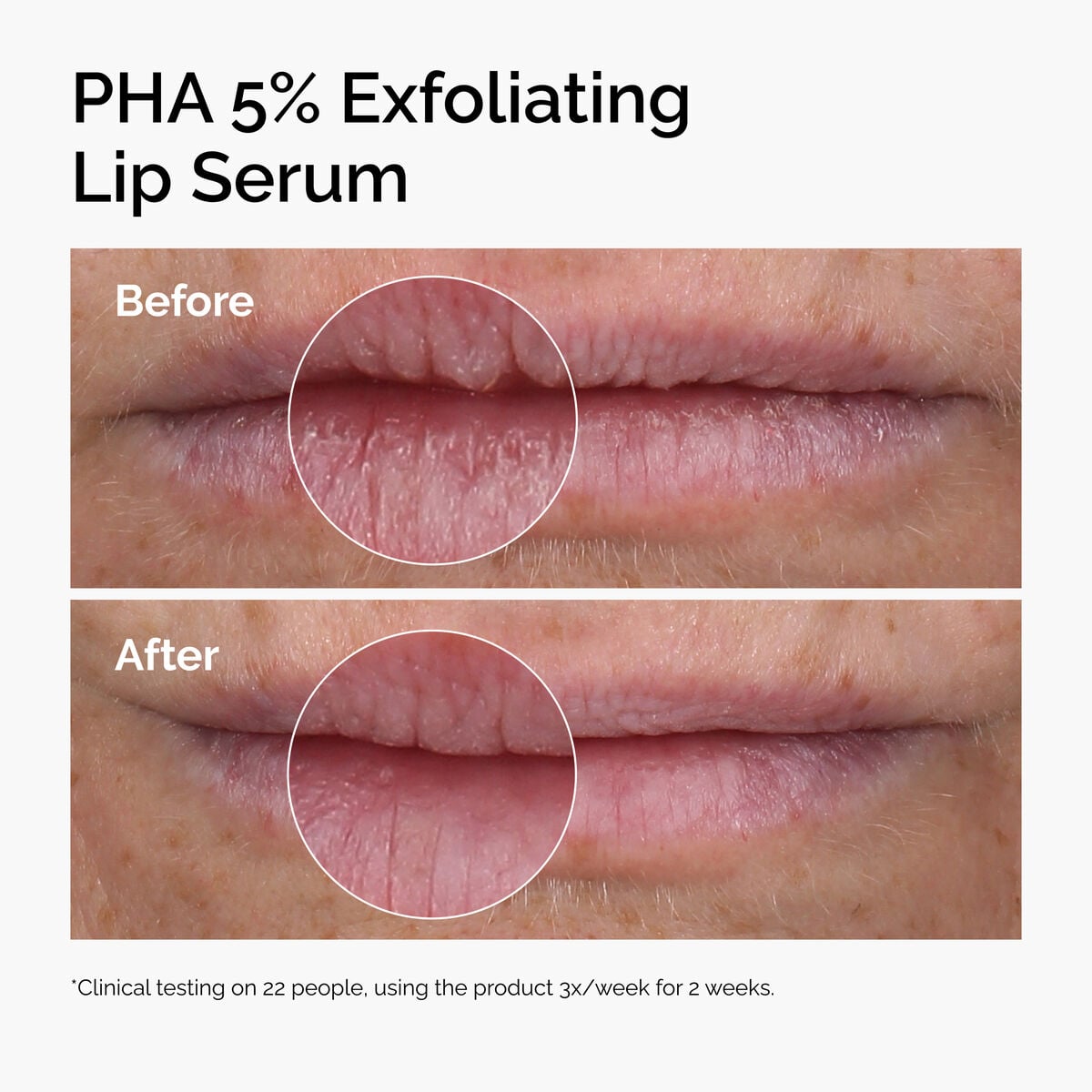 pha-5-exfoliating-lip-serum-z4 ord-pha-5pct-lip-exfoliating-serum-before-after.jpg